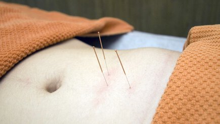 Reviews of Acupuncture clinics in Ireland